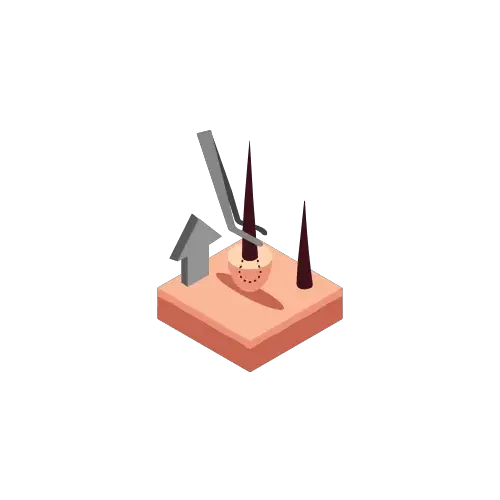 Extraction