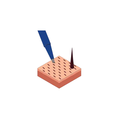 Channel opening